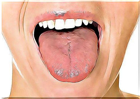 6 remedies for mouth ulcers