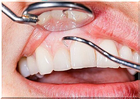 7 solutions against inflamed gums