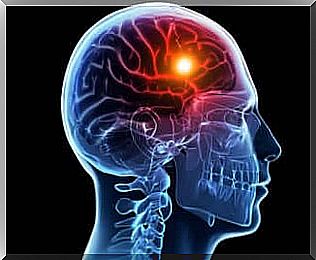 Coronavirus stroke