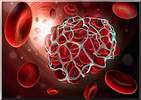 How can you prevent thrombosis?