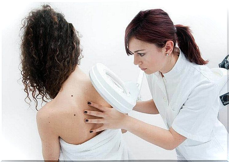 A doctor examines moles