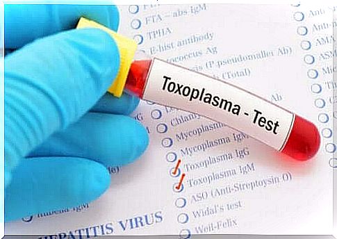 Ocular toxoplasmosis test