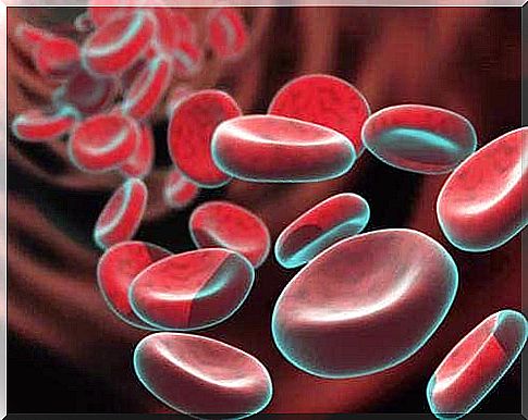 What are the causes of iron deficiency anemia?