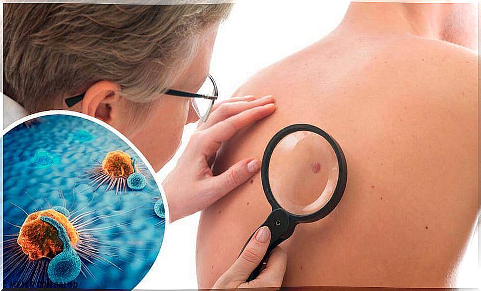 Recognize and respond to signs of skin cancer