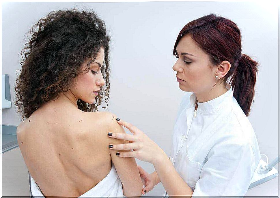 Signs of skin cancer such as melanoma