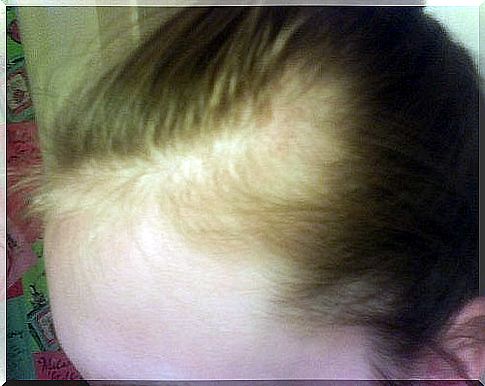 Skin diseases on the head