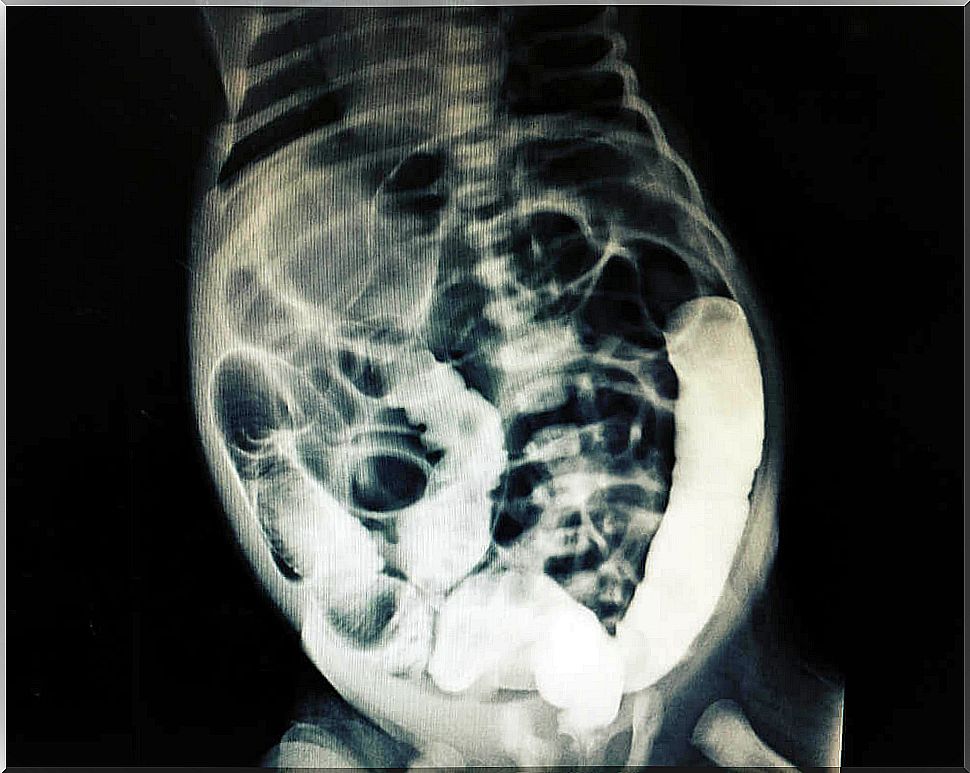 Abdominal irrigation