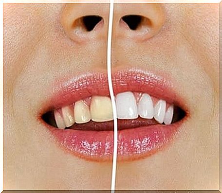 Whiter teeth with natural products